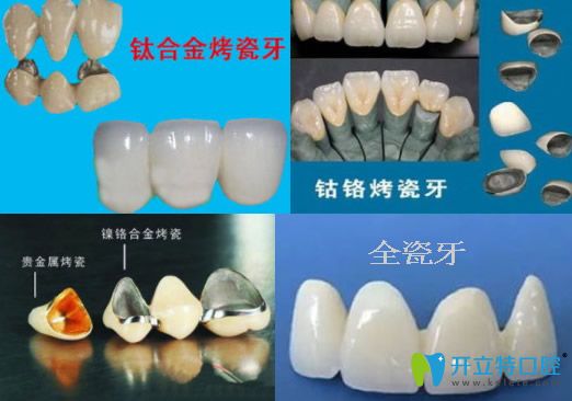 TA2钛合金硬度、熔炼与铸造工艺与扭转性